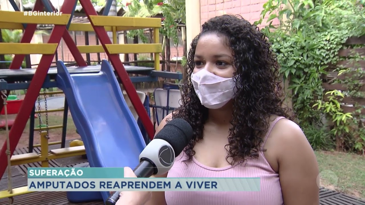 Amputados se superam e reaprendem a viver