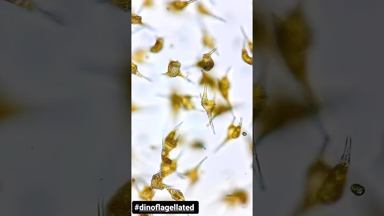 The Microscopic view of Dinoflagellates.....