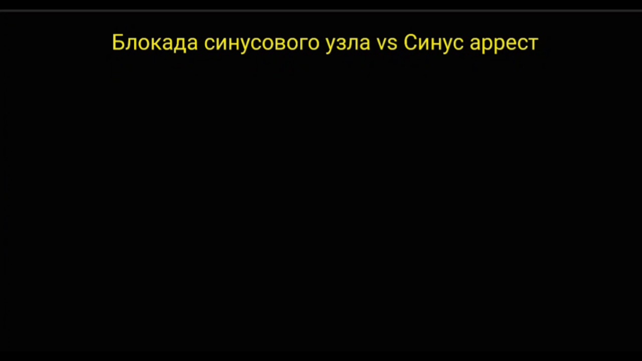 Разница блокады синусового узла от остановки синусового узла(sinus arrest)