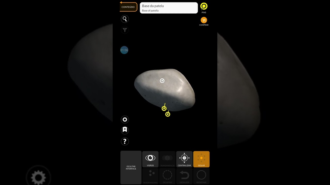 Patela: Anatomia 1 Medicina Unicerrado.