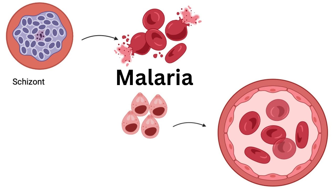 UNDERSTANDING the LIFE CYCLE of PLASMODIUM falciparum: Stages of Malaria Infection Explained