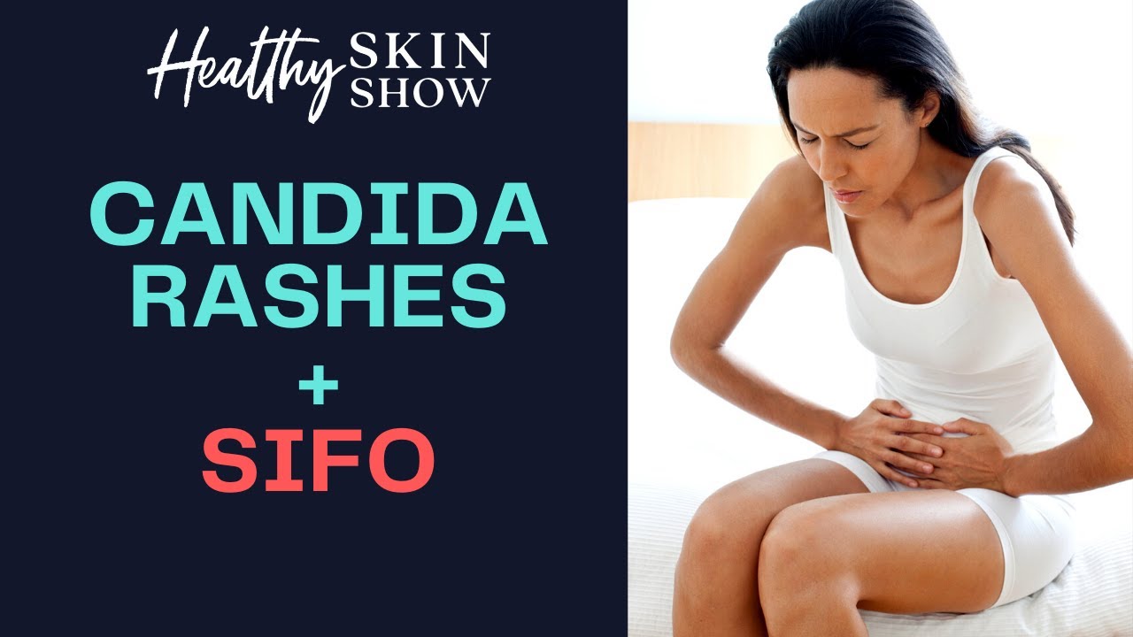 CANDIDA Rashes + SIFO | Dr. Christine Maren