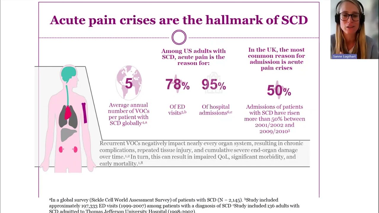 Acute Pain Management in Sickle Cell Disease, Dr Lugthart (HCC Education Session 06/11/23)
