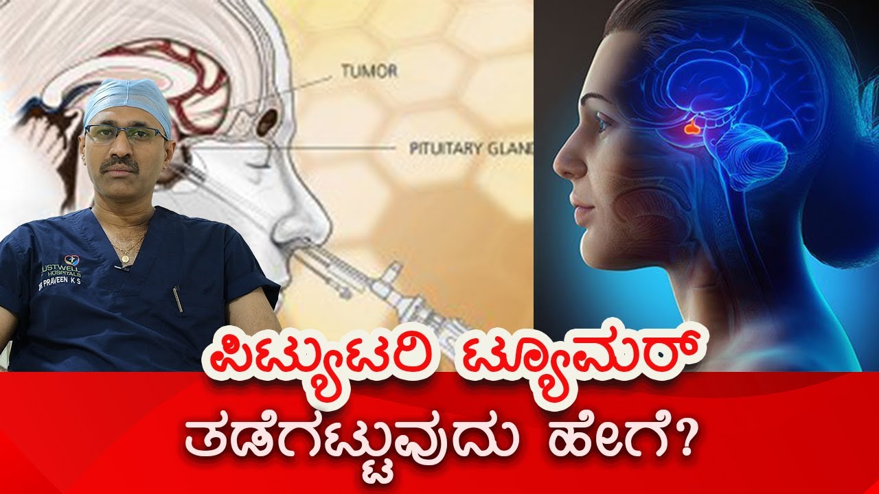 Pituitary tumors - Diagnosis and treatment | Vijay Karnataka