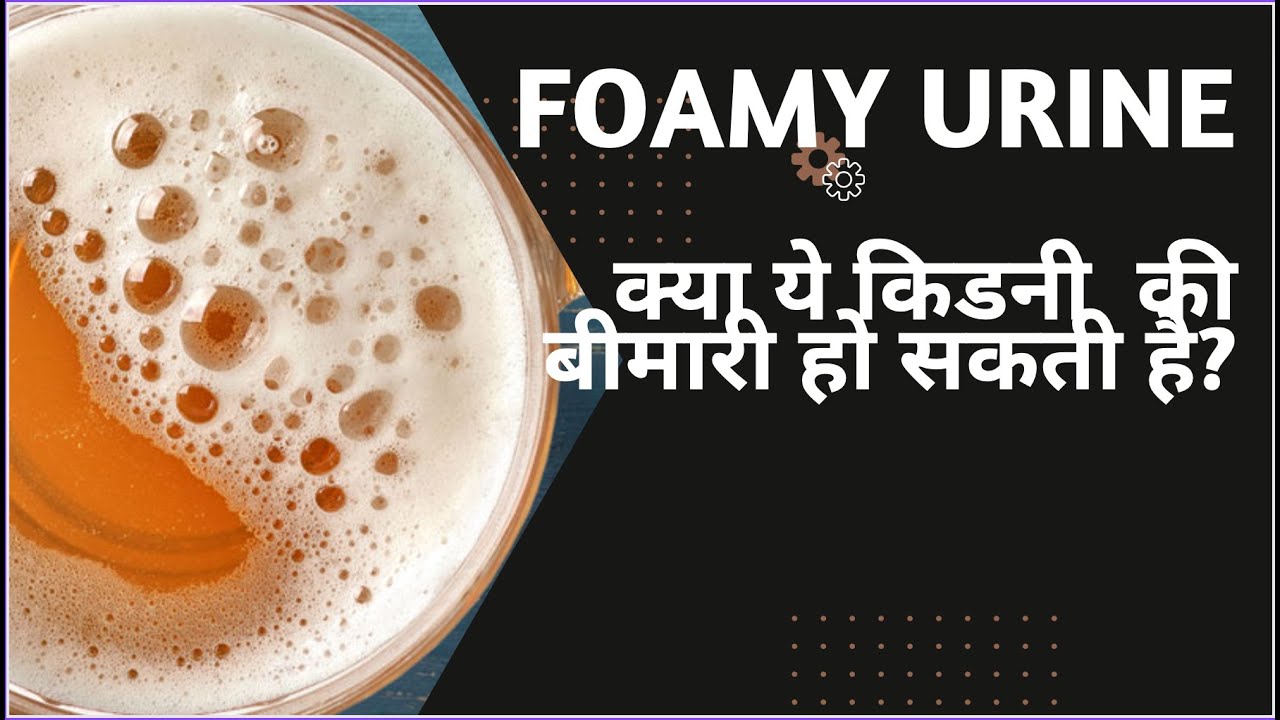 पेशाब में झाग : क्या यह किड्नी की बीमारी के कारण हो सकता है? Foamy Urine