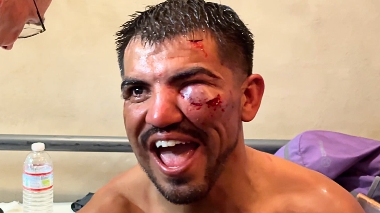 Victor Ortiz BATTERED & BRUISED in Bare Knuckle boxing debut vs Salcido- HIGHLIGHTS