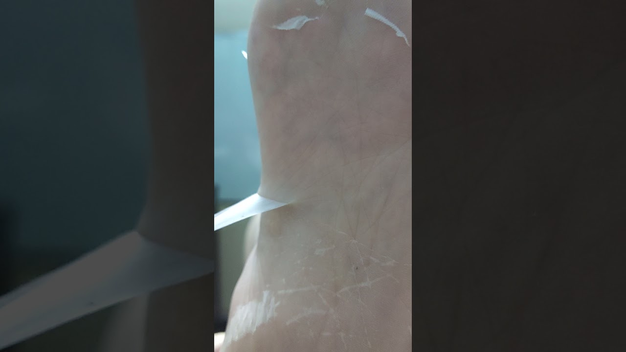 satisfying skin peeling underfoot, ASMR available. watch with caution.