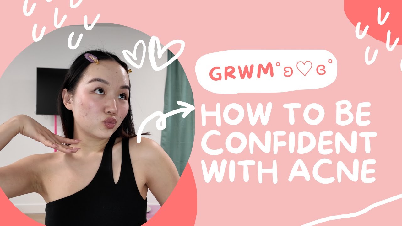 Как обрести уверенность в себе при акне | GRWM для мероприятия