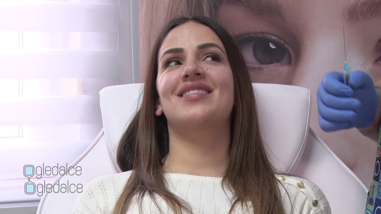 Ogledalce ogledalce 17 - (hijaluronski fileri za volumen obraza, korekcija donjih kapaka)