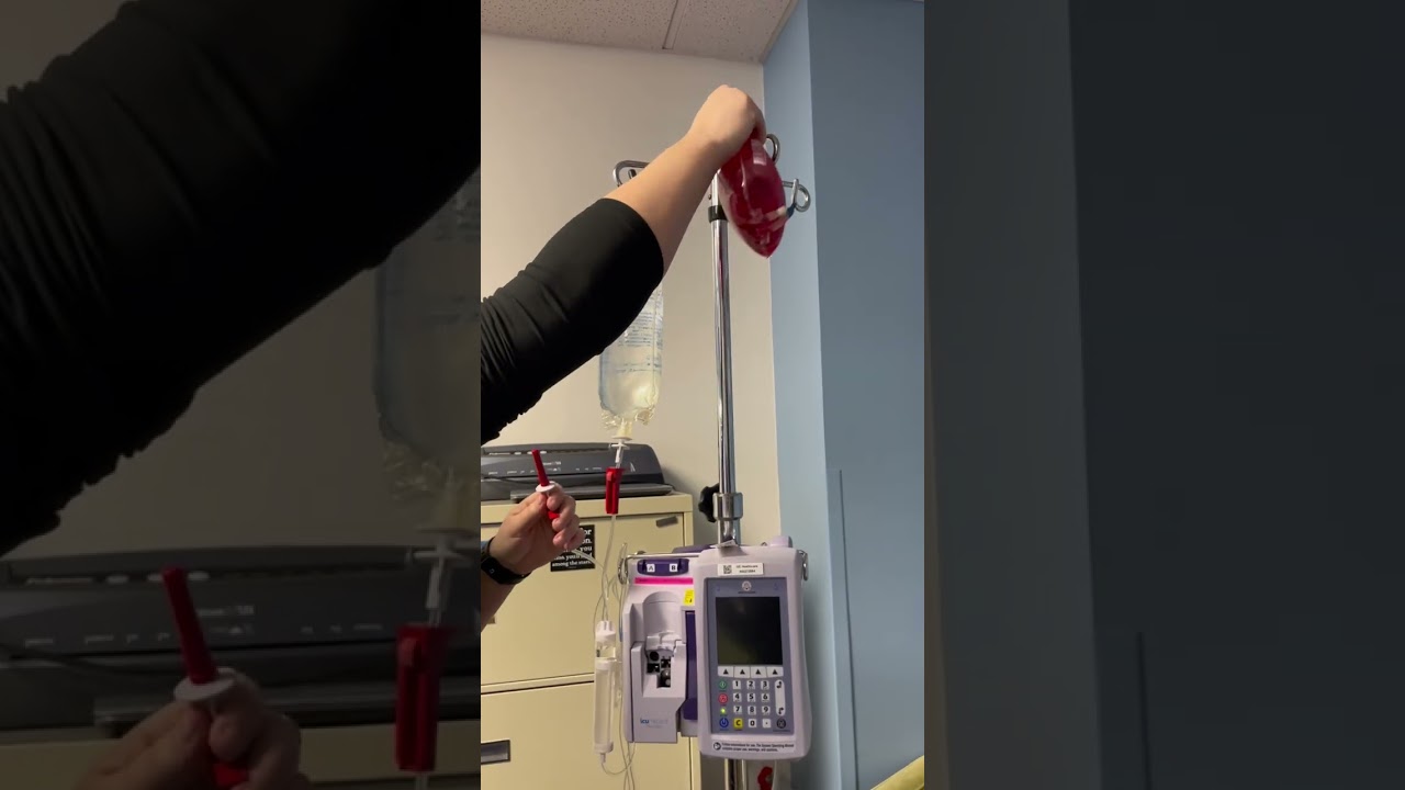 Priming ICU Medical Y-Type Blood Tubing