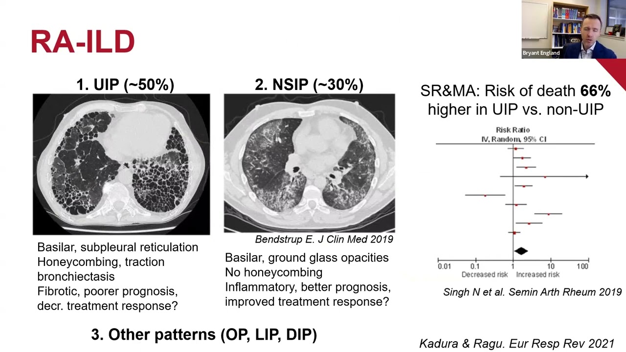 UW Rheumatology Grand Rounds - Bryant England, 1/6/2026