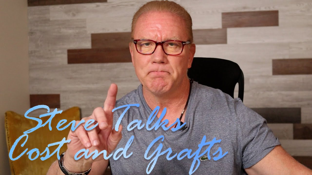 Hair Transplant Cost and Hair Grafts - Steve Talks about Hair Loss Treatments