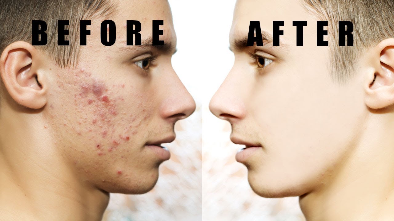 Skin Retouching in photoshop cs6| PSstudio |