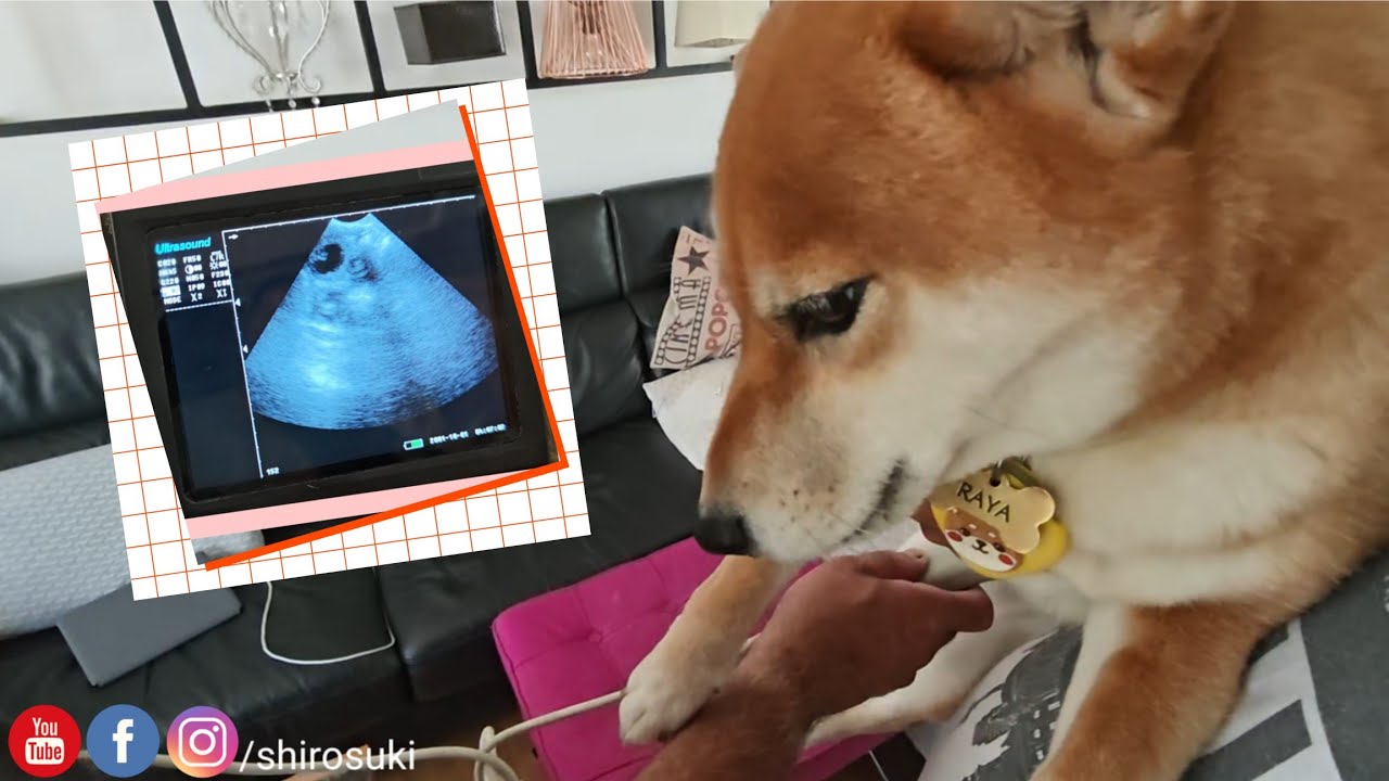 The big day has arrived! Time for the ultrasound results! 🥔🥔??