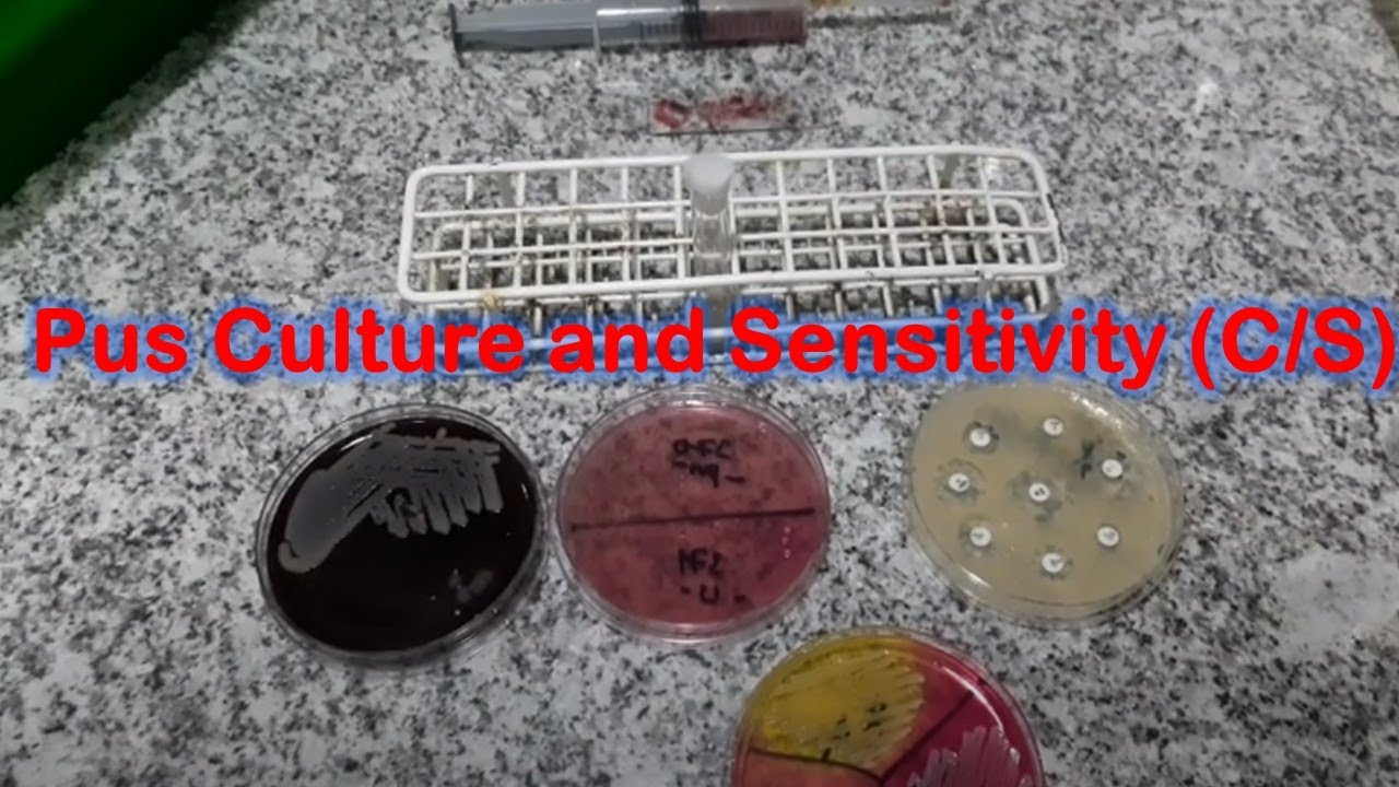Staphylococcus aureus isolation from Pus Culture and Antibiotics Sensitivity Testing