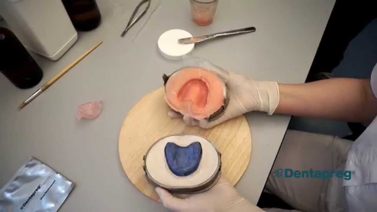 Dentapreg MESH denture reinforcement - instructional video