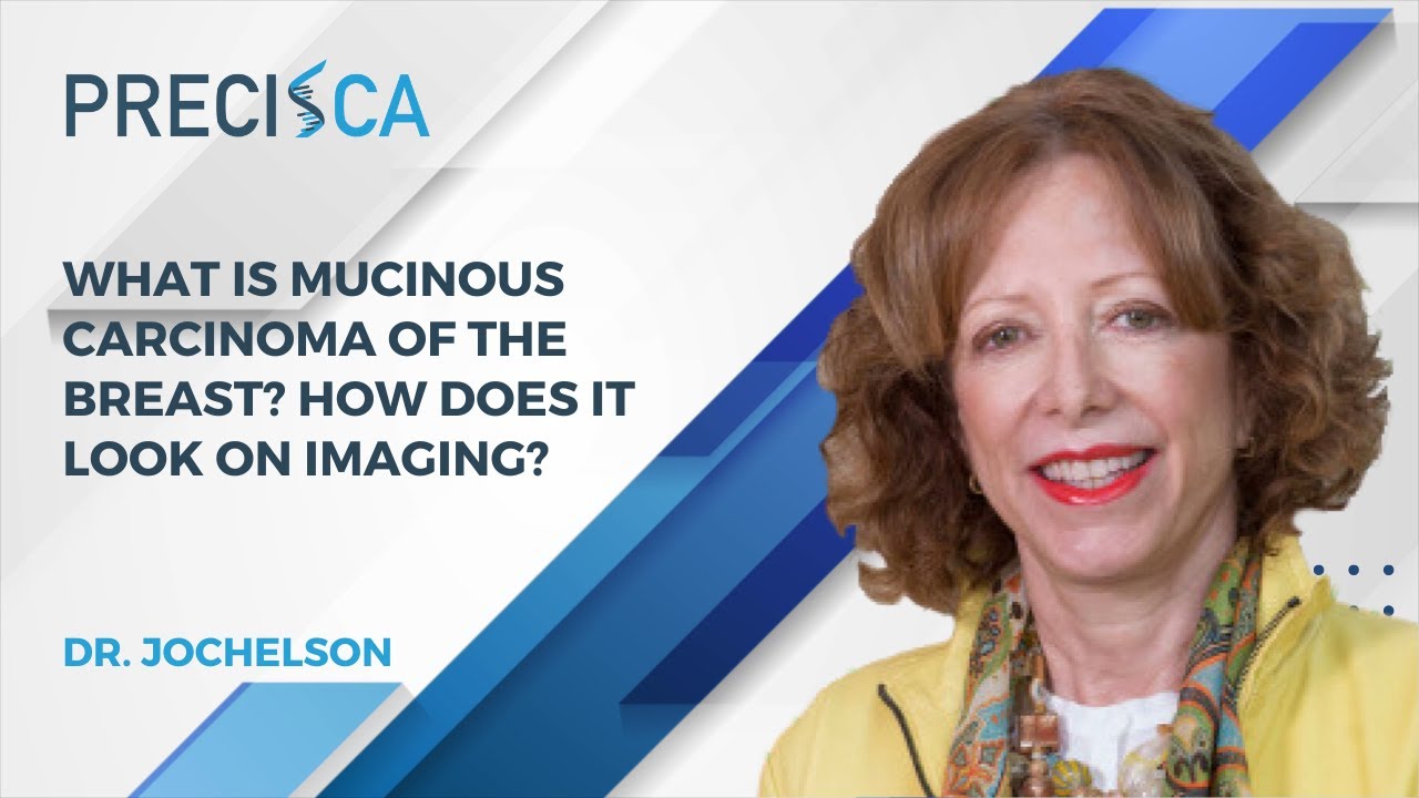What is mucinous carcinoma of the breast? How does it look on imaging?