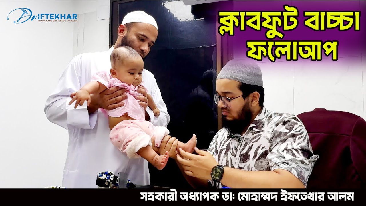ক্লাবফুট বাচ্চা সম্পূর্ণ সুস্থ | Clubfoot Treatment by Dr.Iftekhar Alam #clubfoot #health #doctor