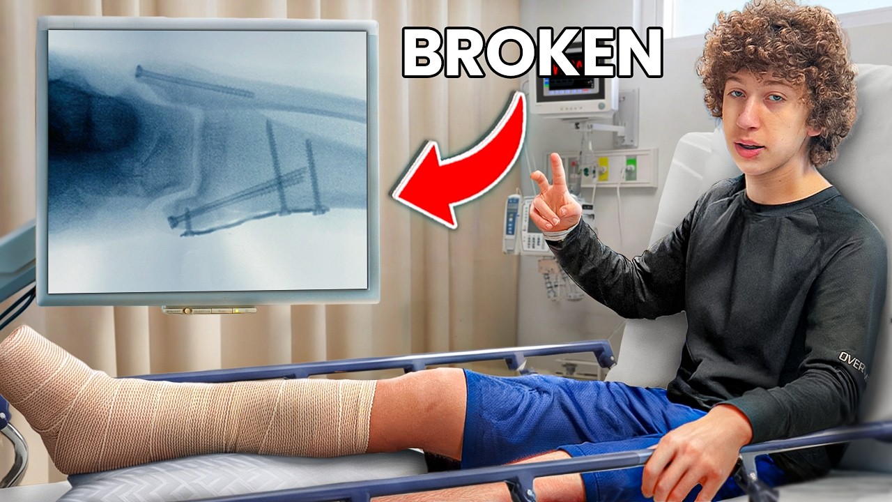 How I Broke My Ankle&hellip;