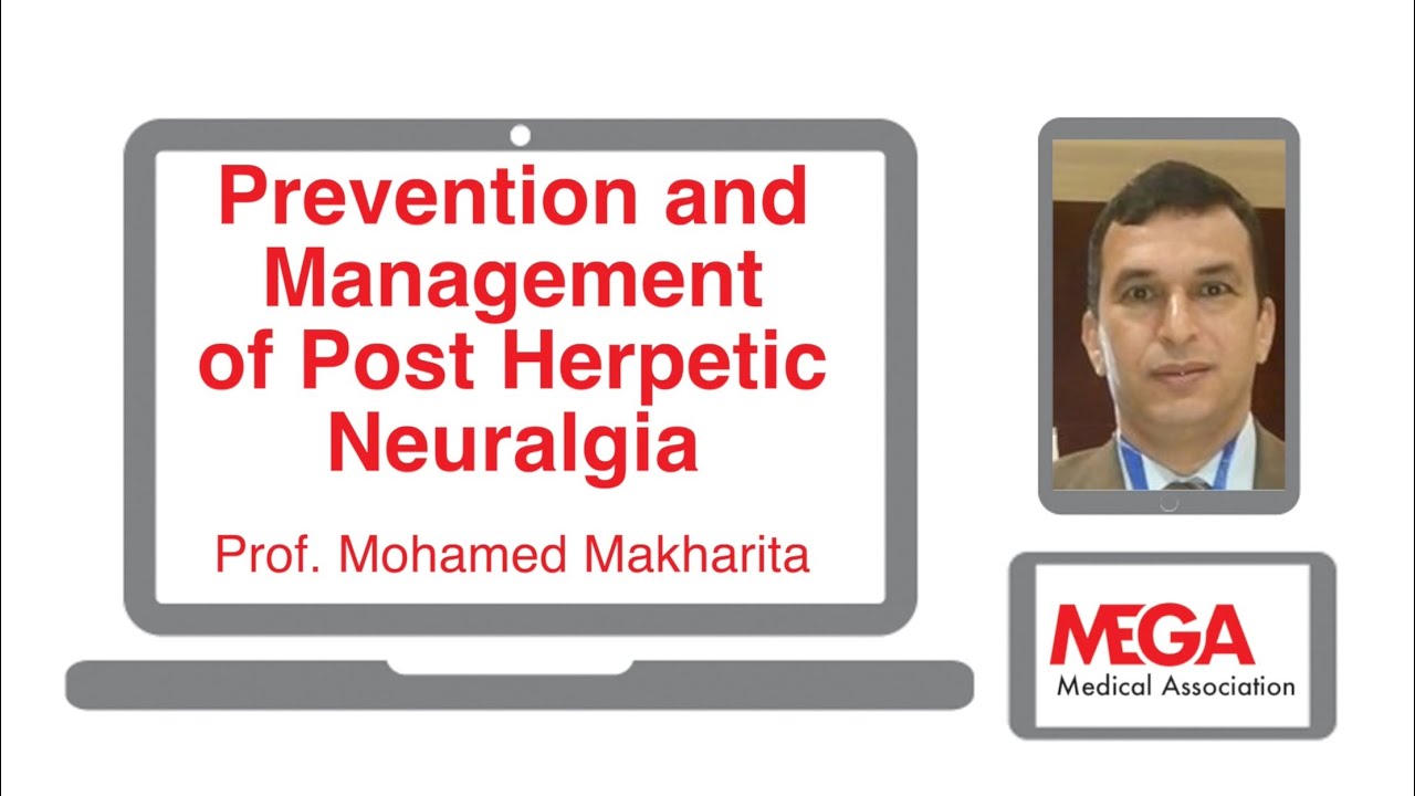 Prevention and Management of Post Herpetic Neuralgia by Prof. Mohamed Makharita