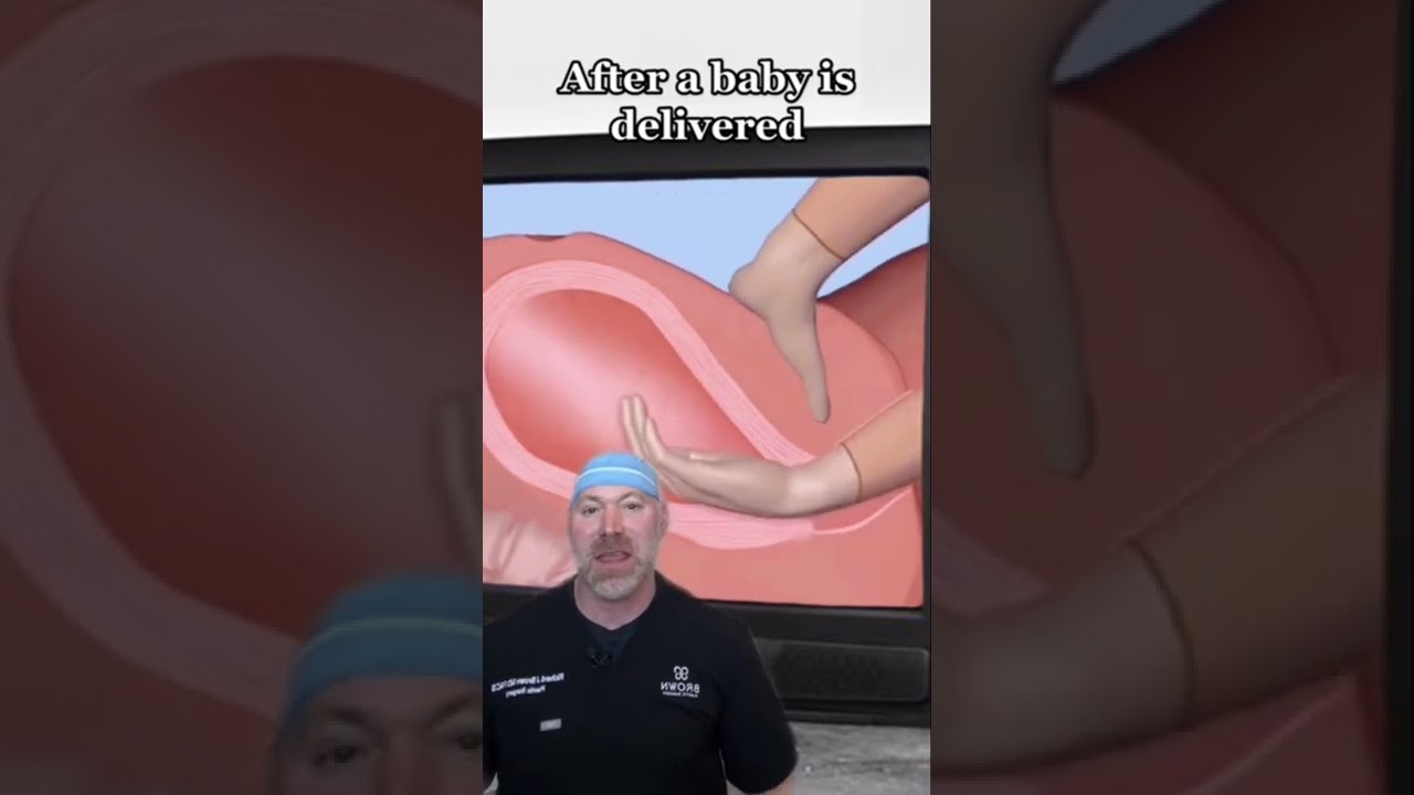 Removing a Placenta by Hand?! 😱 #shorts