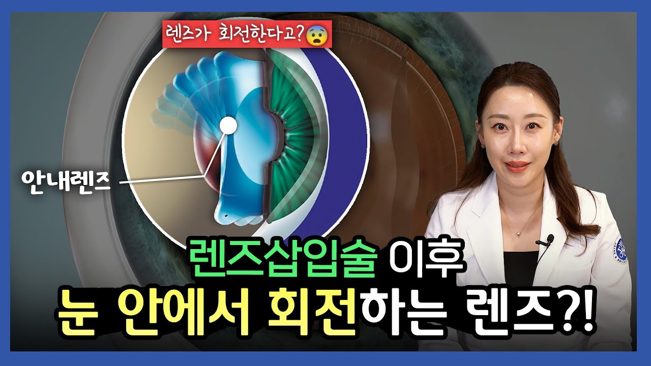 렌즈삽입술 후 렌즈가 회전한다?! 토릭 안내렌즈에 대한 오해와 진실!