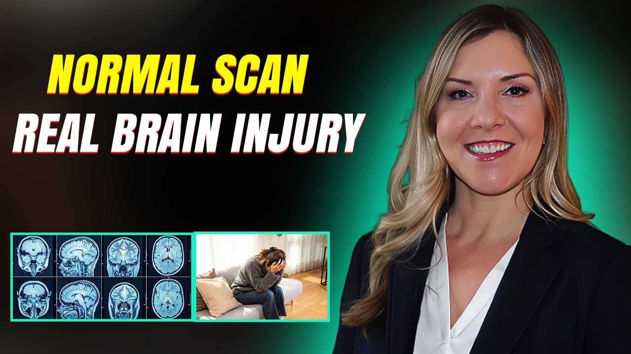 Normal CT Scan, But Still a Brain Injury?