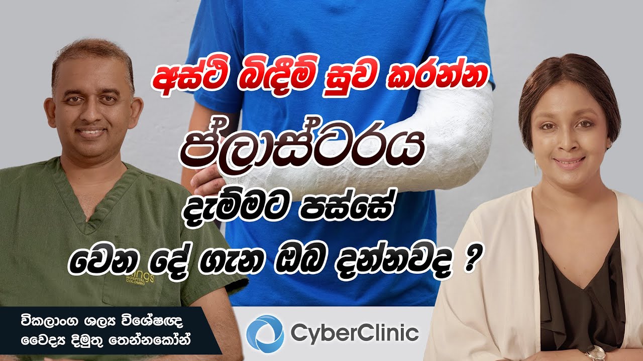 අස්ථි බිඳීම් සුව කරන්න ප්ලාස්ටරය දැම්මට පස්සේ වෙන දේ ගැන ඔබ දන්නවද? Cyber Clinic