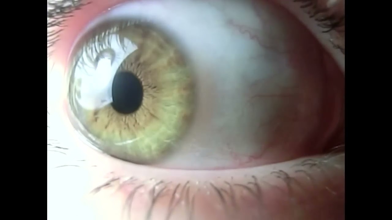 Ondulaciones del Iris moviendose a camara lenta 240 fps