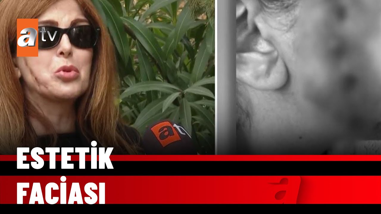 Gülemiyor, ağlayamıyor - atv Haber 7 ocak 2022