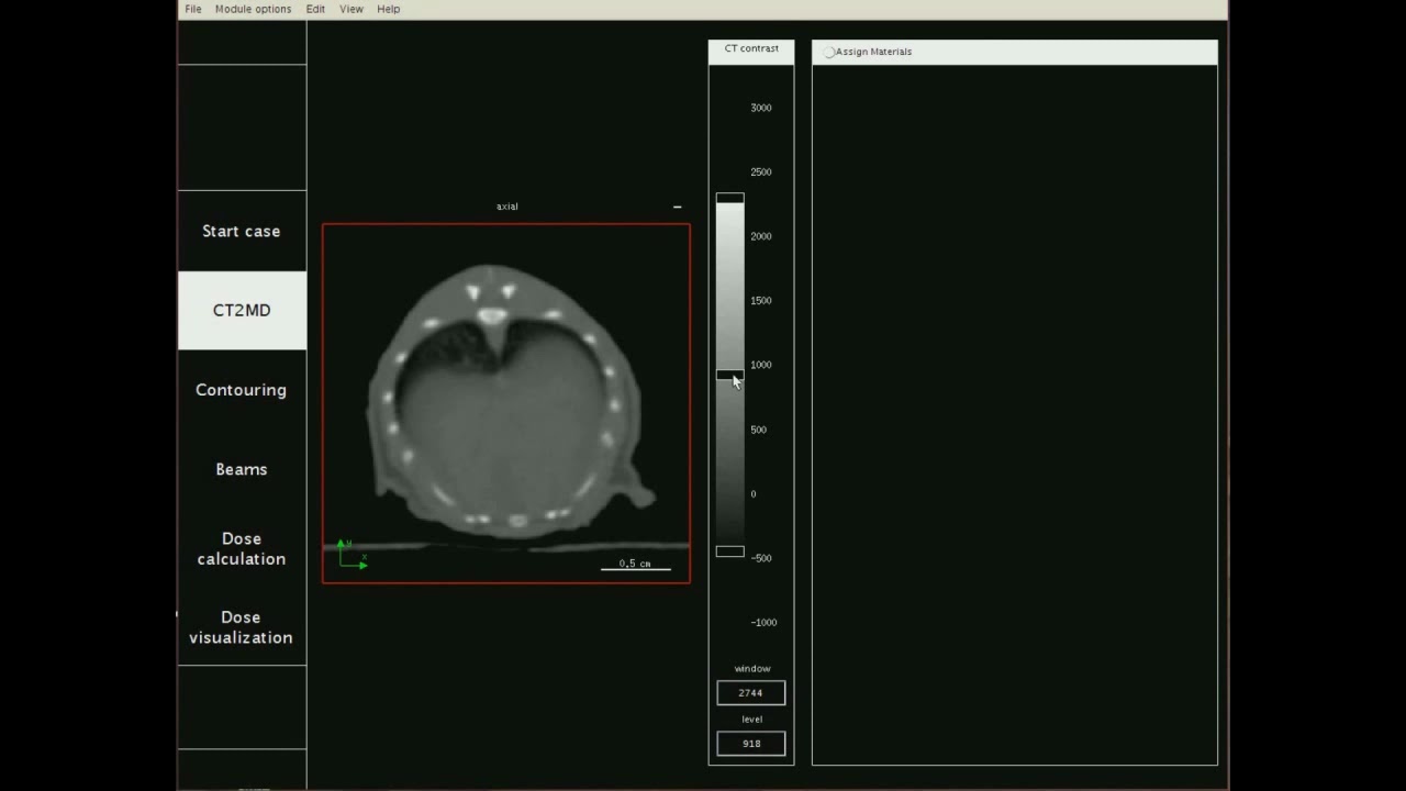 Precision X-Ray SmART Plan Video Demo