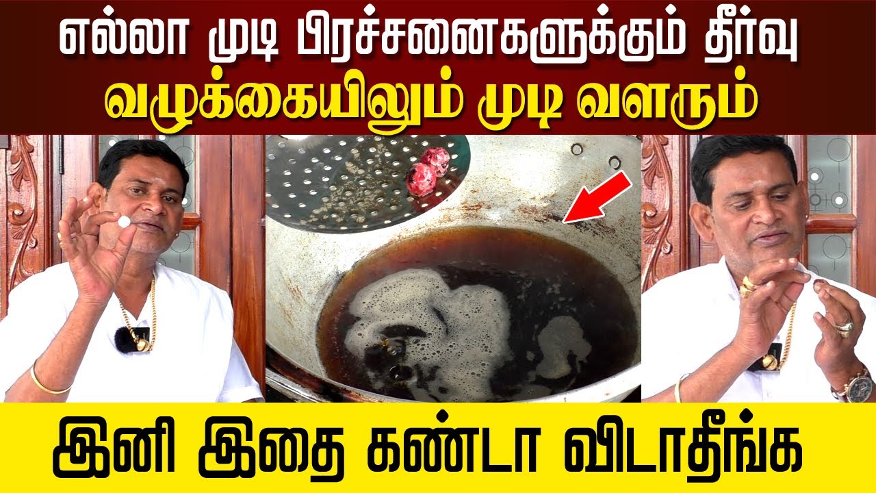 எல்லா முடி பிரச்சனைகளுக்கும் தீர்வு.. வழுக்கையிலும் முடி வளரும்.. இனி இதை கண்டா விடாதீங்க