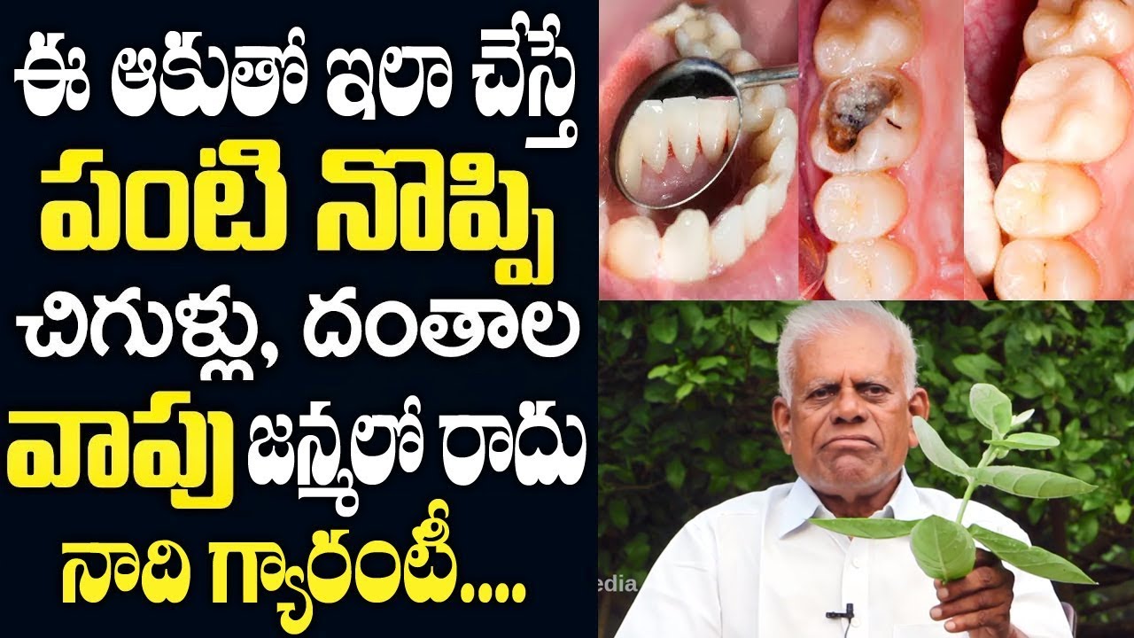 ఈ ఆకుతో ఇలా చేస్తే  2 నిమిషాల్లో పిప్పి పన్నుకు శాశ్వత పరిష్కారం | How To Get Rid Cavities Naturally