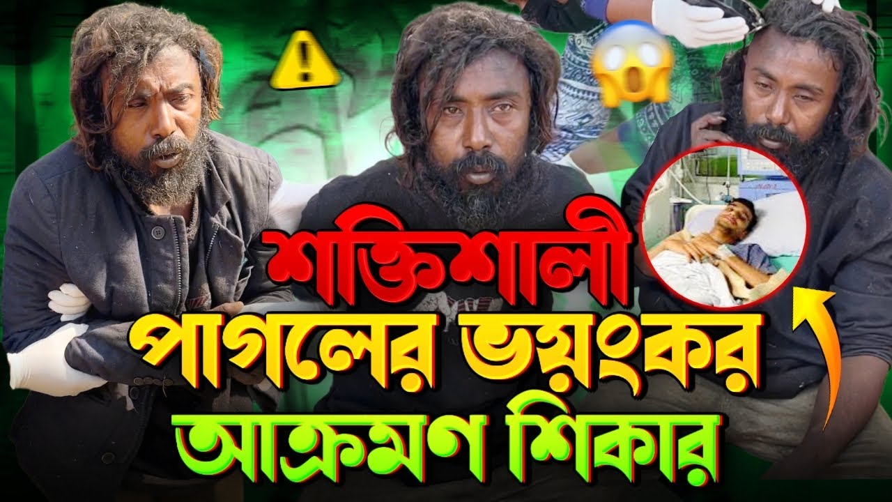 পাগলের অবিশ্বাস্য শক্তি | Unbelievable Strength of a Homeless Man | Street Humanity of Bangladesh