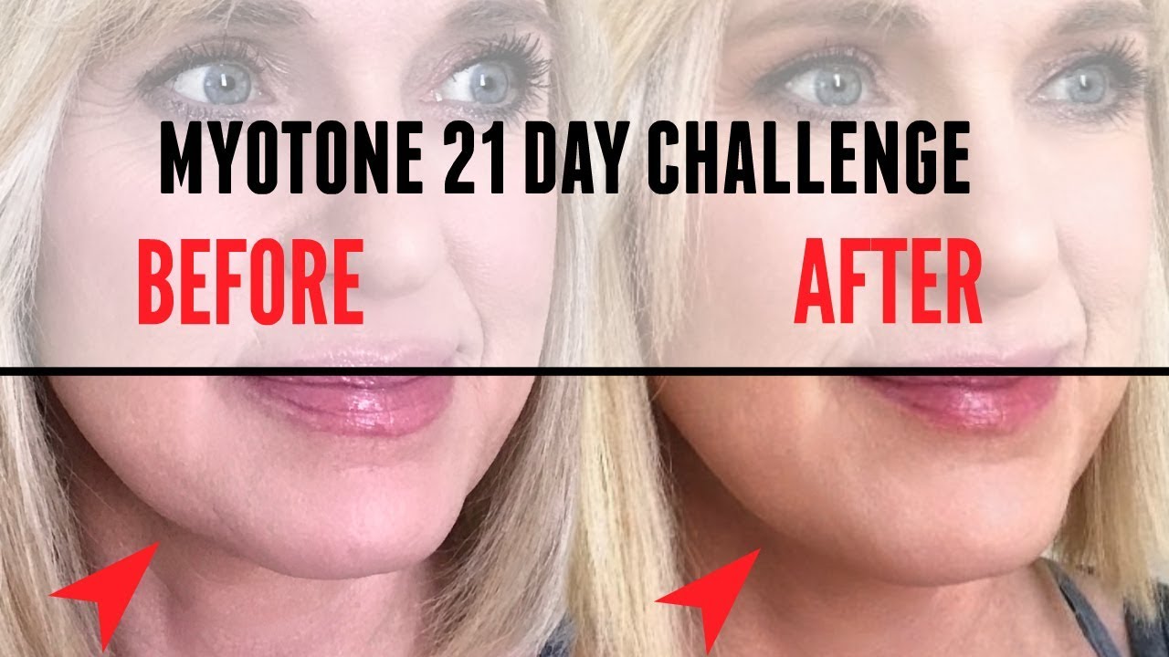 Myotone Microcurrent Device LIFT & TONE Face At Home!
