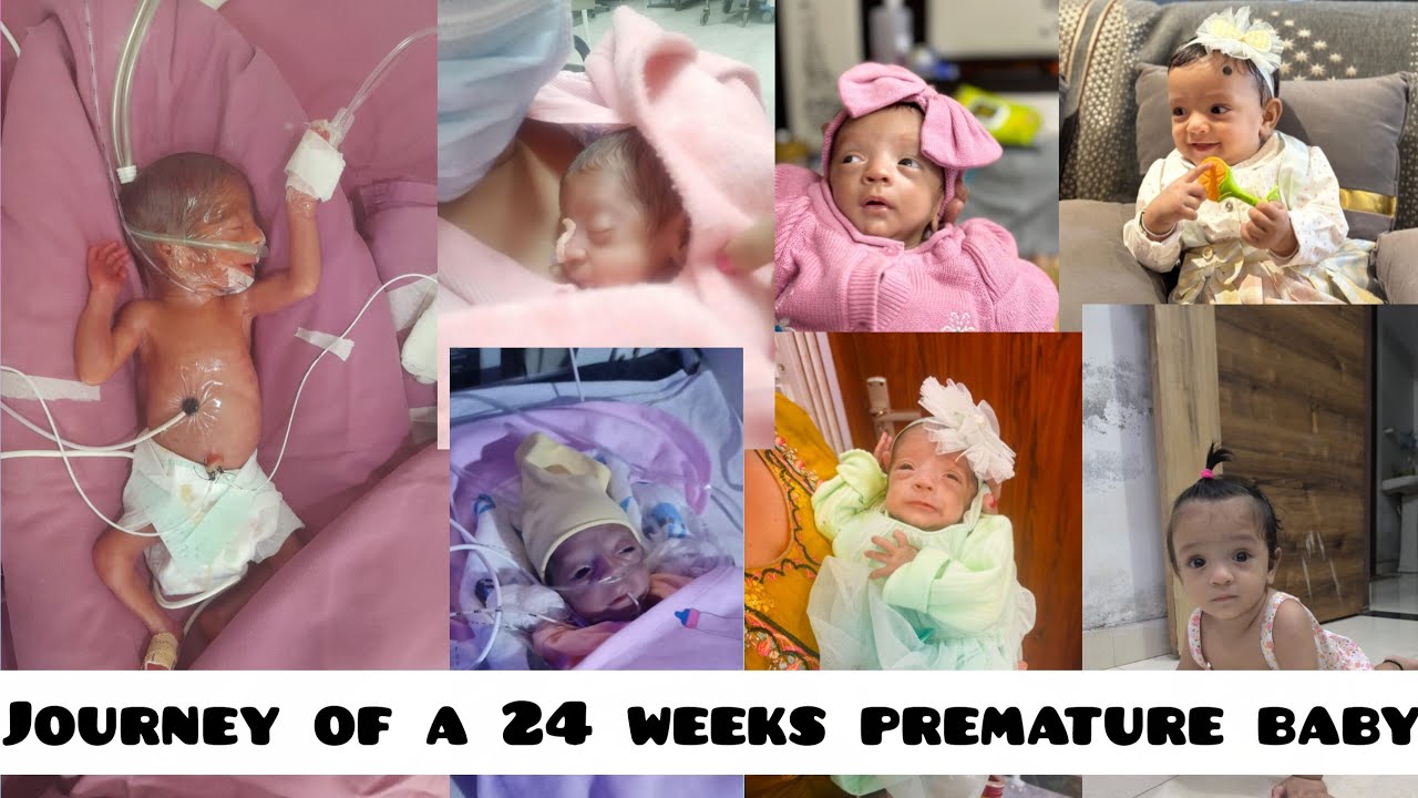 Born at 24 weeks weight 600 gram # journey of NICU to home #niculife  #fightergirl #baby 