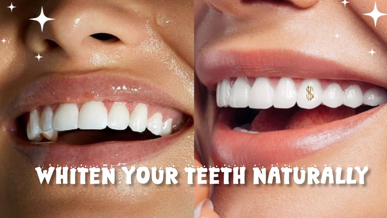 How to whiten your teeth naturally 🌷 easy tips and tricks 🦷 @shahwarqamar0296