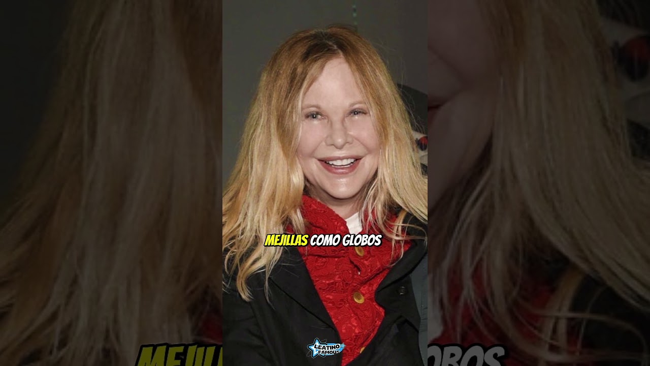 Las 5 peores cirug&iacute;as de famosas de Hollywood que cambiaron su rostro para siempre