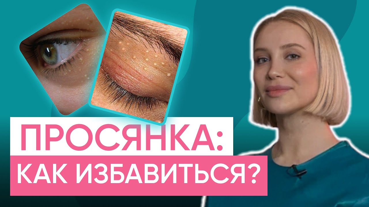Что такое просянка, причины появления и способы избавления!