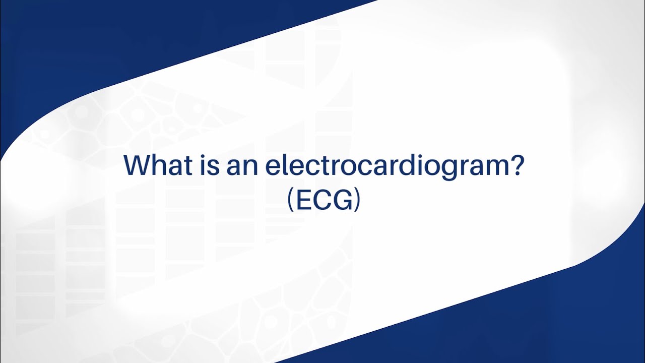 Douglass Hanly Moir Pathology (DHM) Cardiology - ECG