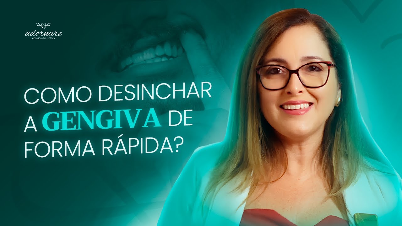 GENGIVA INCHADA: o que pode ser e como desinchar de forma rápida? |  Adornare Odontologia Estética