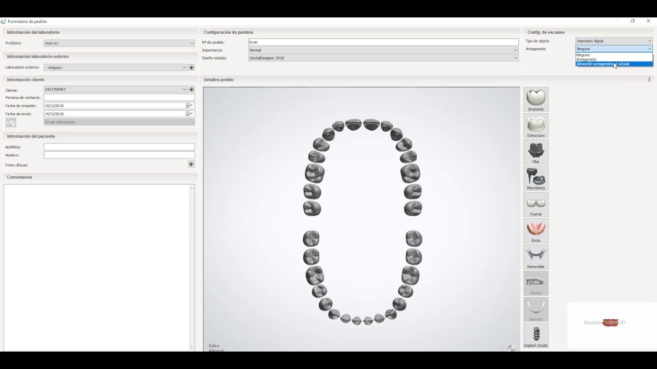 Prótesis Dental / 3shape / crea ficha de trabajo+importar scaneo+cofia con anatomía reducida.