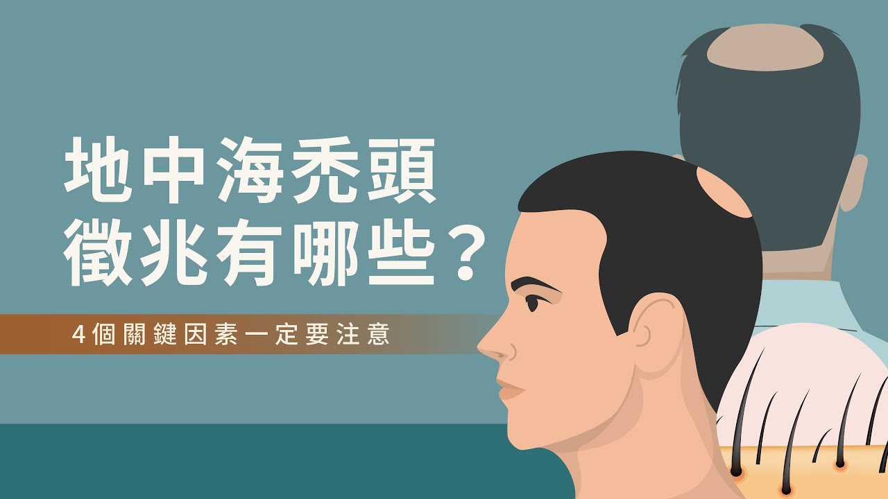 地中海禿頭徵兆有哪些？4個關鍵因素一定要注意｜植髮診所推薦