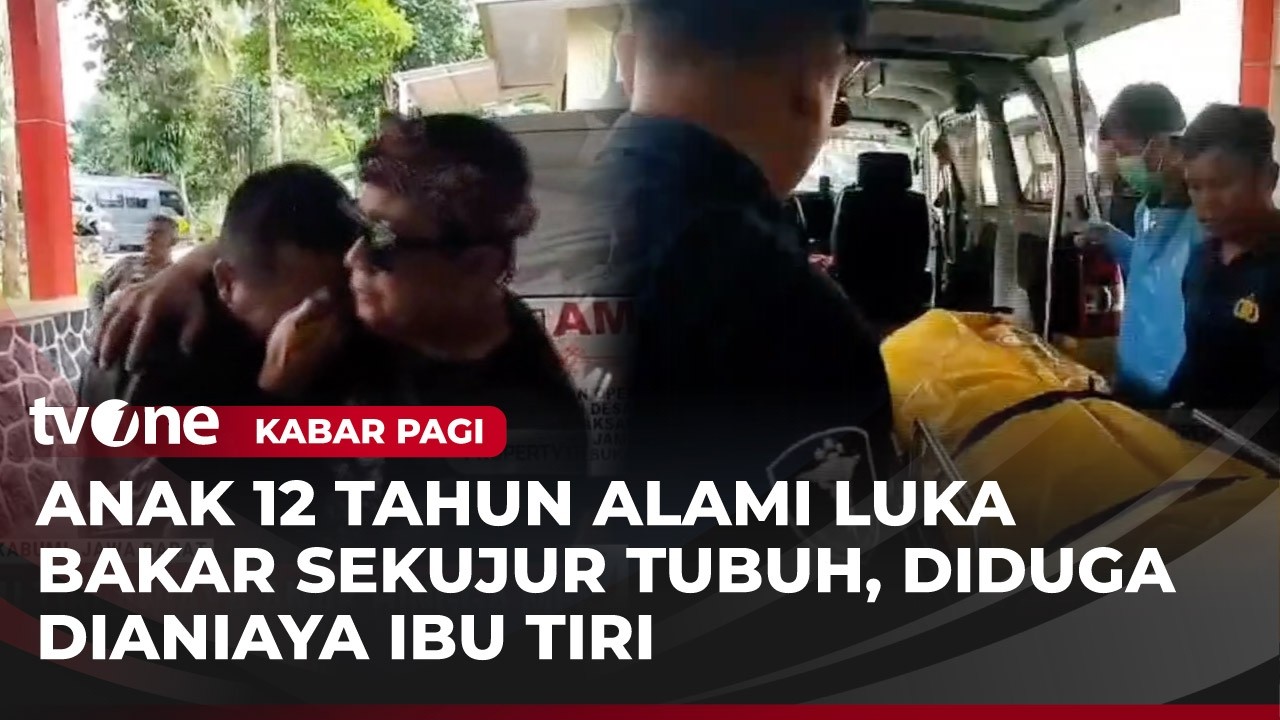 Dianiaya Ibu Tiri, Anak di Sukabumi Meninggal Dunia Akibat Luka Bakar | Kabar Pagi