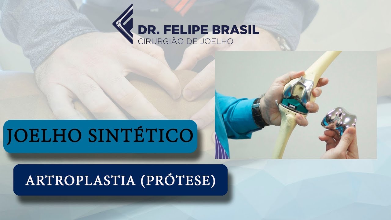 ARTROPLASTIA (PRÓTESE) TOTAL DO JOELHO - WORKSHOP