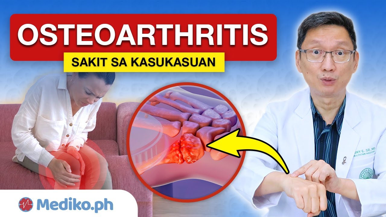 OSTEOARTHRITIS: Sanhi, Sintomas, at LUNAS