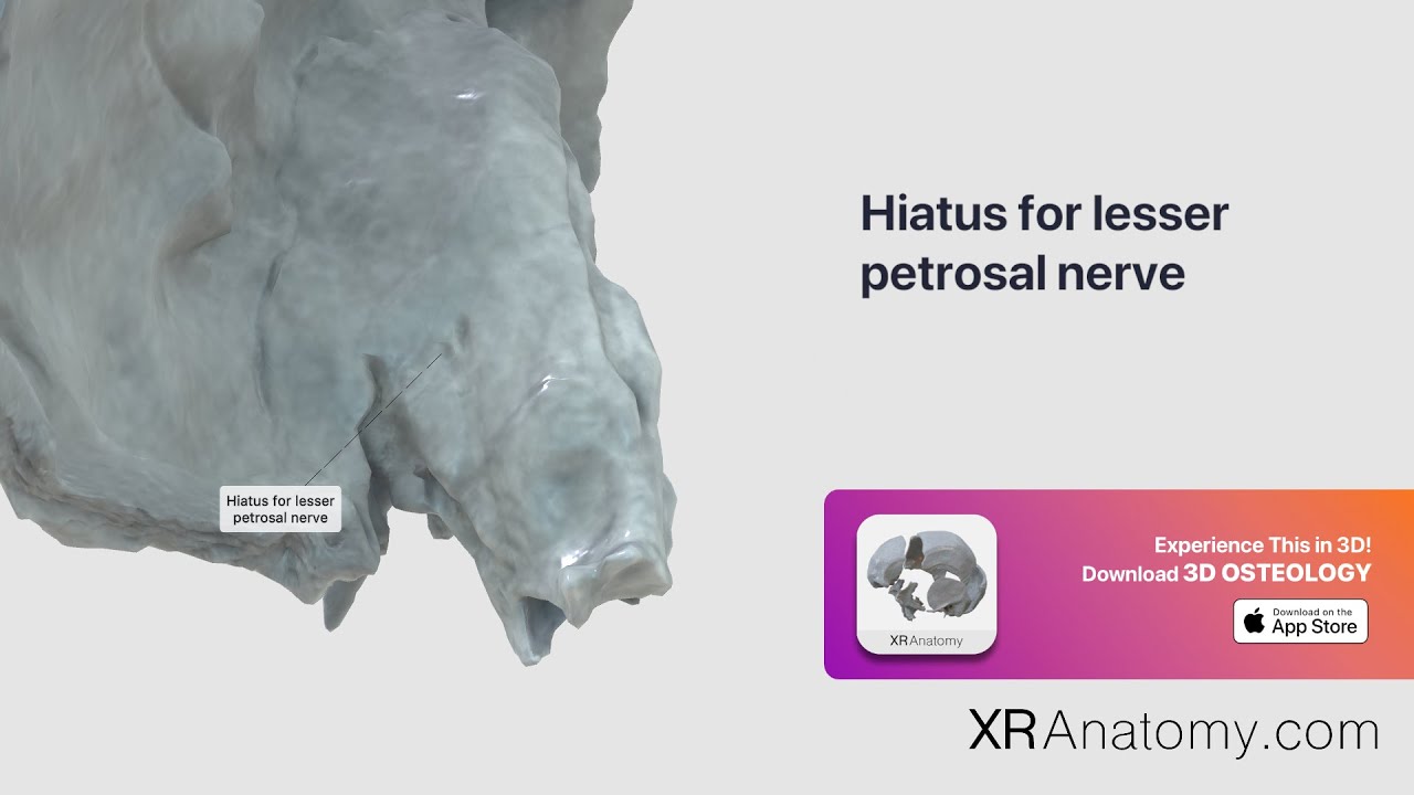 Temporal Bone - Hiatus for lesser petrosal nerve