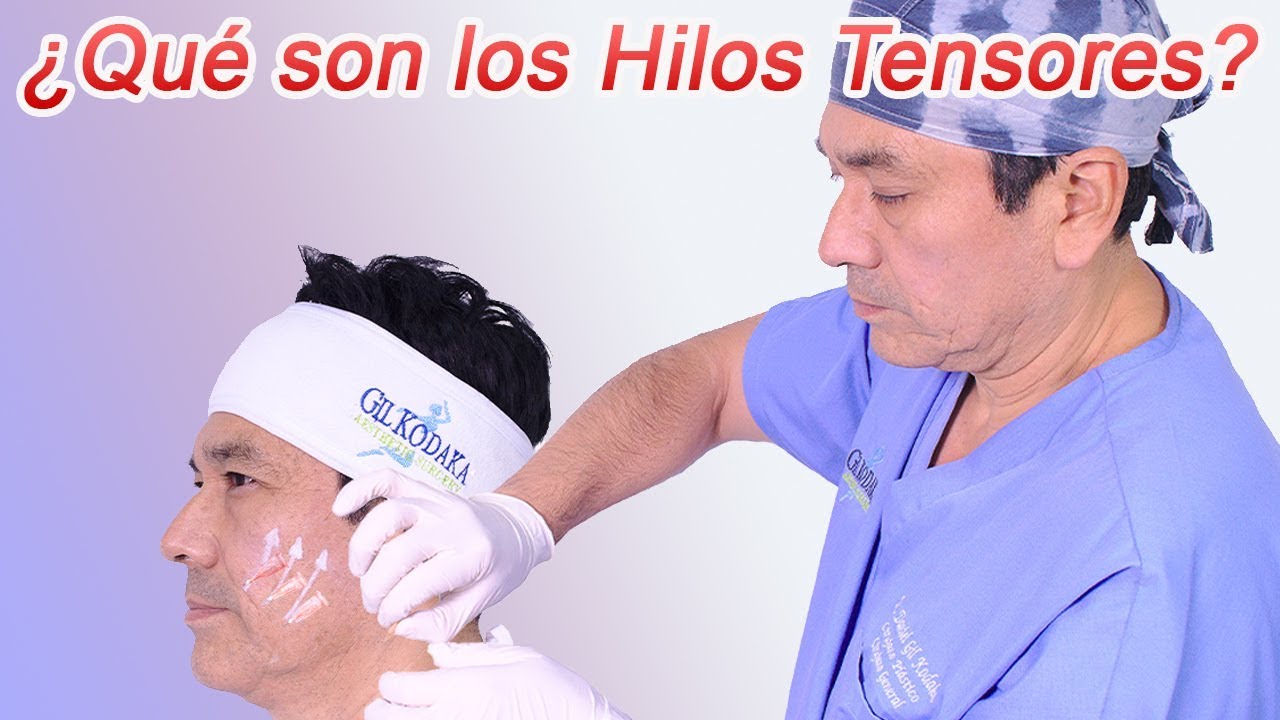¿Qué son los Hilos Tensores?