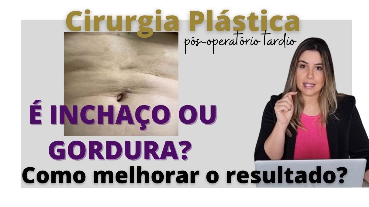 Gordura ou inchaço? Dúvida comum no pós-operatório de cirurgias plásticas!