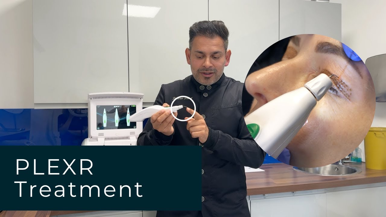PLEXR Treatment: Everything You Need To Know | Dr Dev Patel